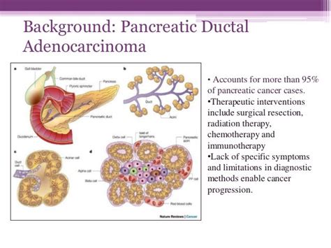 pdac by Kelsey Lopez, PhD