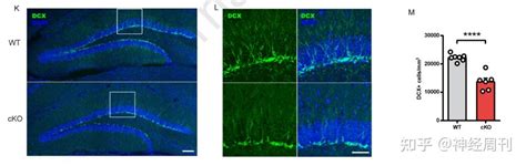 高天明院士团队揭示星形胶质细胞依赖于胆碱能受体调控海马神经再生 知乎
