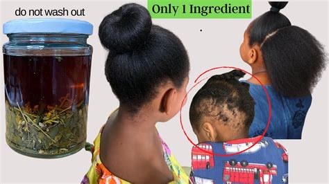 Extremely Effective Natural Remedy To Fight Hair Loss And Speed Up Hair