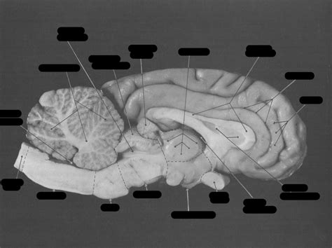 Figure 6 Medial View Of Sheep Brain Diagram Quizlet