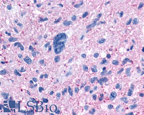 PathPlus NPFFR1 GPR147 Polyclonal Antibody Rabbit Anti Human LSBio