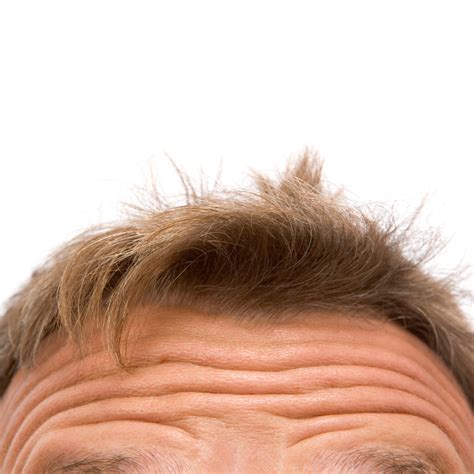 Todo Sobre El Pelo Fino En Hombres Blog De Mhc