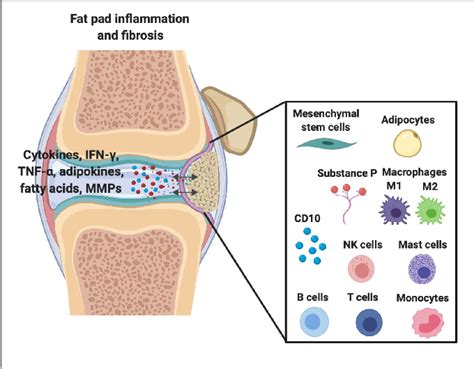 Figure 2 from Infrapatellar Fat Pad/Synovium Complex in Early-Stage Knee Osteoarthritis ...