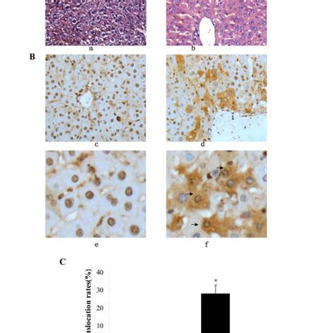 Lps And Tnf Stimulated Hepg Cells To Release Hmgb In A Time And