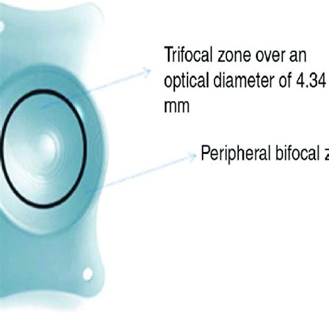 Refractive Outcomes Before And After Implantation Of At Lisa Tri Toric Download Scientific