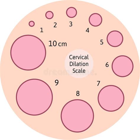 Cervial Dilation Scale With Pink Circles Shows How Cervix Is Opening