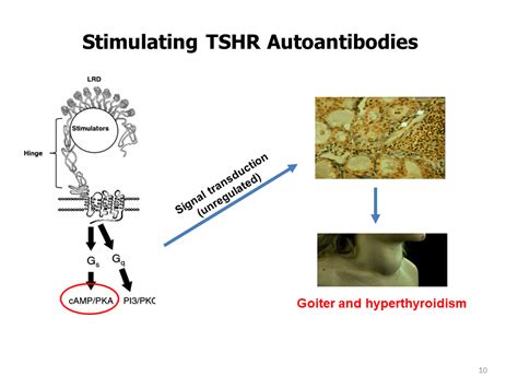 TSH Receptor Antibodies, Clinical Applications and Clinical Relevance