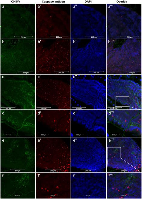 Detection Of Activated Cleaved Caspase Antigen In Epithelial Cells Of