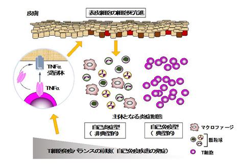 自己免疫疾患の新たな病態発症メカニズムを解明炎症性疾患におけるT細胞の新たな役割 テックアイ生命科学