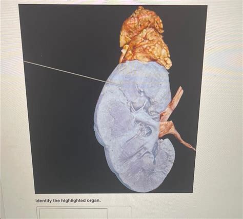 Solved Identify The Highlighted Organ Identify The Hig