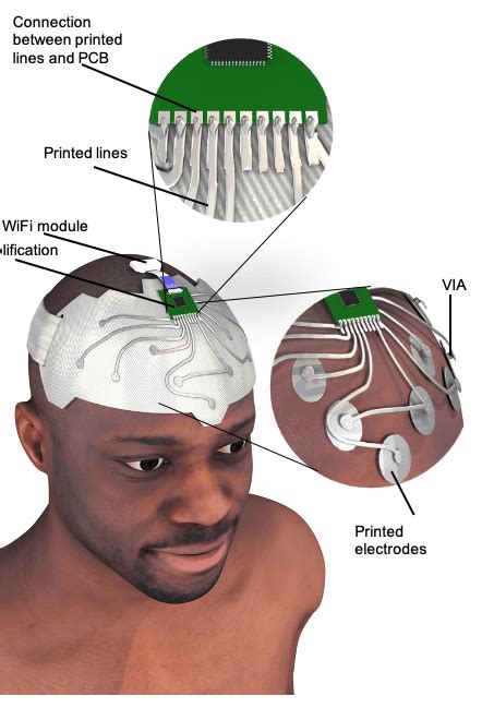 Textile Eeg Acquisition Headband Proposed In This Work Top Detail