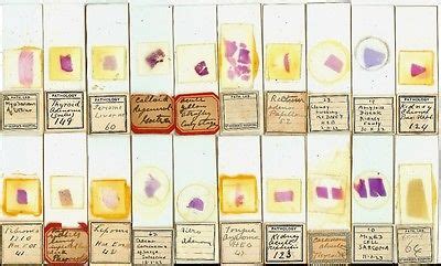 Collection of 20 Human Pathology Microscope Slides -- Antique Price ...