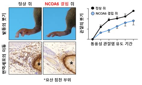 통풍성 관절염 발생 핵심 단백질 발견 헬스코리아뉴스