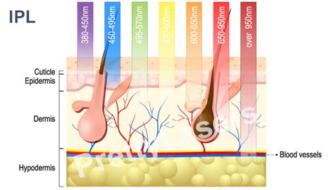 IPL VS Laser Hair Removal Treatment - Hair Removal | PrettyLasers