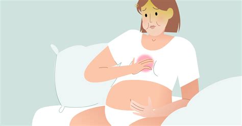 Your Guide To Dealing With Heartburn During Pregnancy