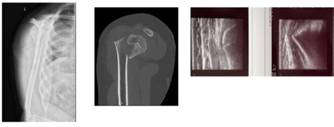 MSK Radiology Flashcards Quizlet