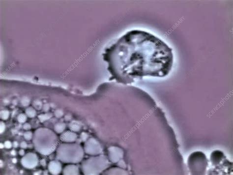 Entamoeba Histolytica Lysis Stock Video Clip K0032916 Science Photo Library