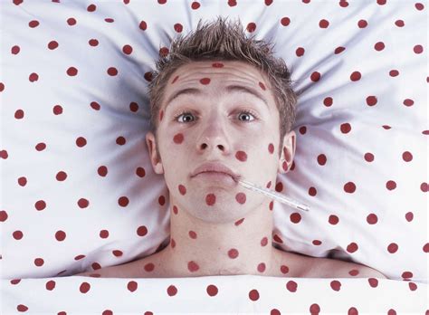 Can You Get Chickenpox Twice? Chances, Causes, and More