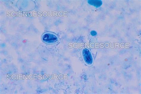 Giardia Lamblia 400x