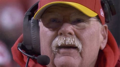 It was so cold Andy Reid’s mustache froze and Mahomes’ helmet cracked