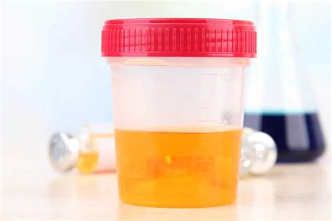 Dark Orange, Amber or Brown Urine Could Indicate a Liver Problem