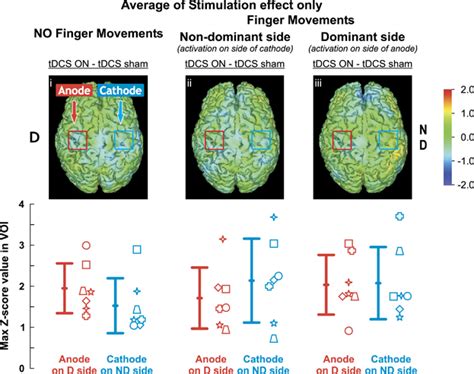 Regional Cerebral Blood Flow Rcbf Changes With Bilateral Transcranial