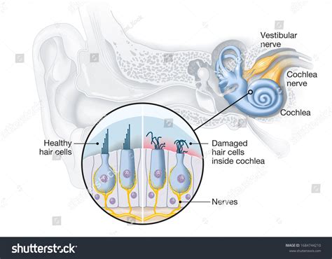 1,212 Ear hair cells Images, Stock Photos & Vectors | Shutterstock