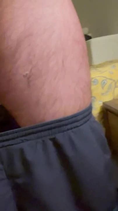 Jaw Dropping Moment From Peyronie S Disease Gay Big Cock Porn Feat