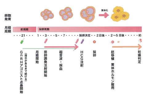 顕微授精・体外受精の流れ｜顕微授精・体外受精なら大阪の不妊専門医レディースクリニック北浜