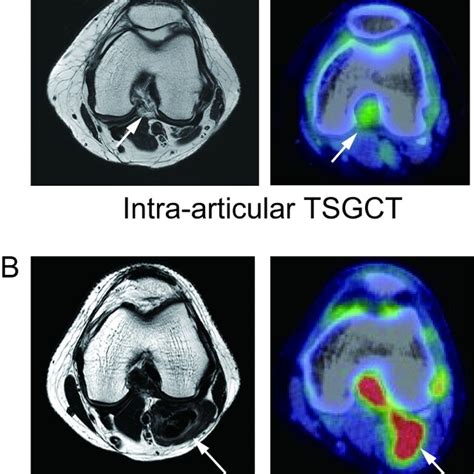 Representative magnetic resonance imaging (MRI) and positron emission ... 