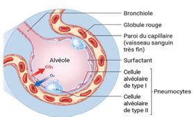 Broncho Pneumopathie Chronique Obstructive Et Sars Cov 2 Arbre Des