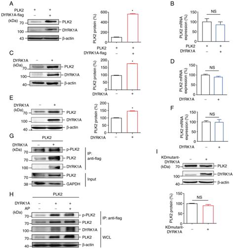 Dyrk1a Mediated Plk2 Phosphorylation Regulates The Proliferation And