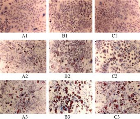 Resistin Stimulates Preadipocyte Differentiation 3T3 L1 Preadipocytes