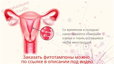Китайский тампон бьютифул лайф. Купить тампон. - YouTube