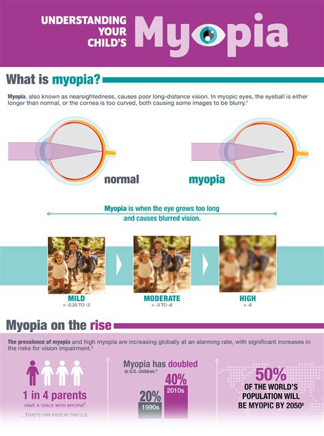 Mymyopia Infographic Press Release Image Review Of Myopia Management