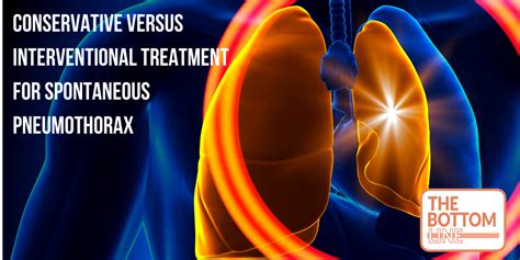 PRIMARY SPONTANEOUS PNEUMOTHORAX PSP TRIAL The Bottom Line