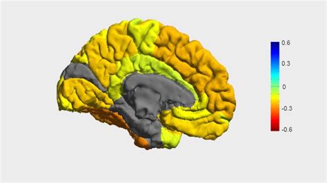 Researchers Create Roadmap Of Bipolar Disorder And How It Affects The