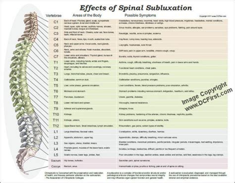 Effects Of Spinal Subluxation Poster Clinical Charts And Supplies