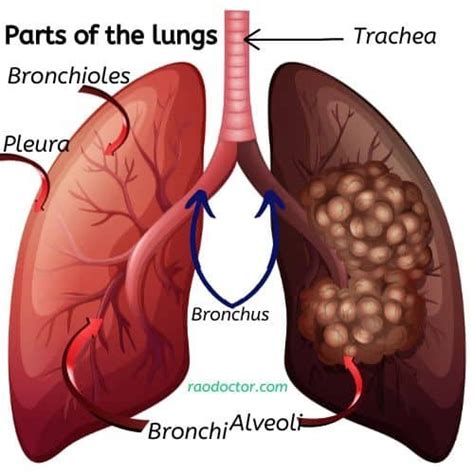 How To Prevent Pneumonia And Stay Healthy 9 Tips For You