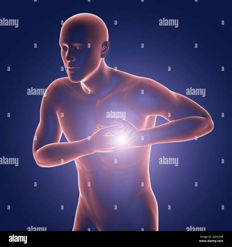 Man With Chest Pain Illustration Stock Photo Alamy