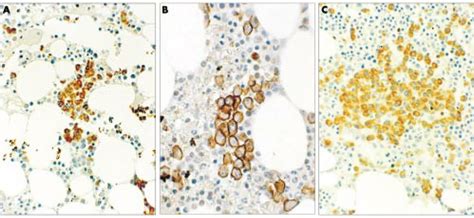 A Haematoxylin And Eosin Staining And B Immunohistochemical Download Scientific Diagram