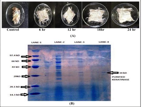 Optimization And Purification Of Keratinase From Bacillus Anthracis