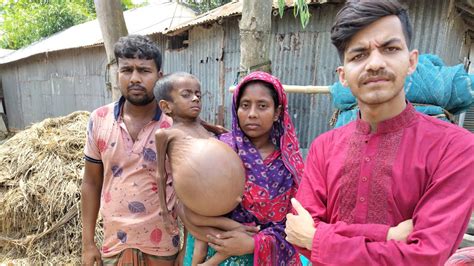 পেট ফেটে গেলে হতে পারে মৃত্যুটাকার অভাবে ৫ বছর ধরে অপারেশন করাতে পারছে