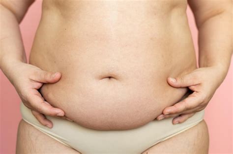 Premium Photo Pinch Woman Sagging Belly Closeup Folds On Stomach