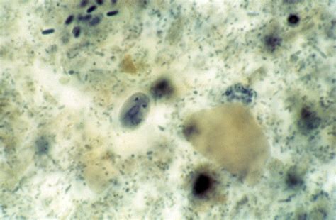 Giardia Lamblia Cyst