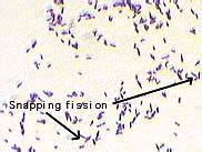 Corynebacterium Gram Stain Morphology