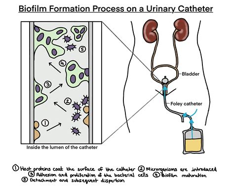 Understanding Bacterial Biofilm Its Formation Com 5