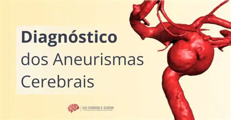 Aneurismas Cerebrais O Que Causa Sintomas E Tratamentos