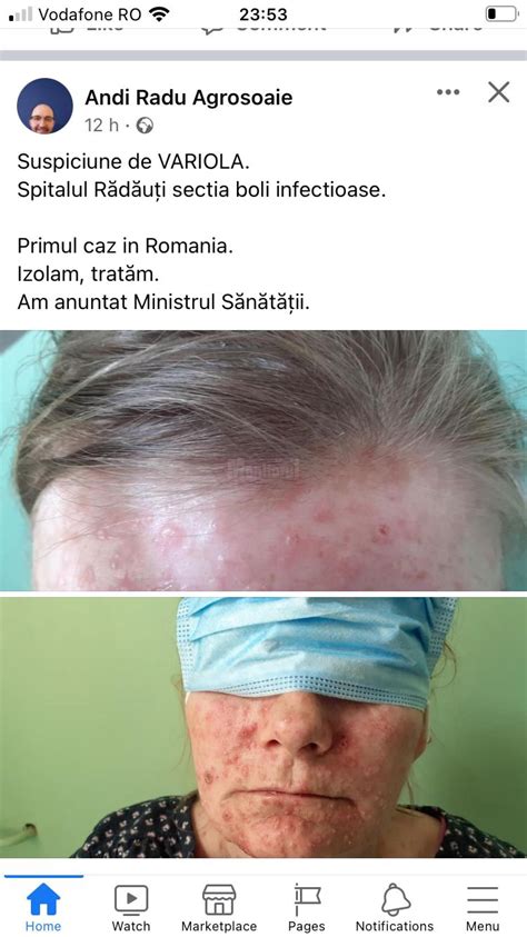 Ultima Ora Local Un Medic Din Radauti A Pus Pe Jar Autoritatile