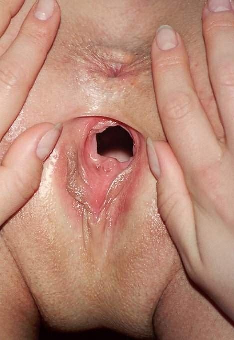 Extreme Homemade Fisting And Object Insertions Porn Pictures XXX Photos Sex Images 3102946